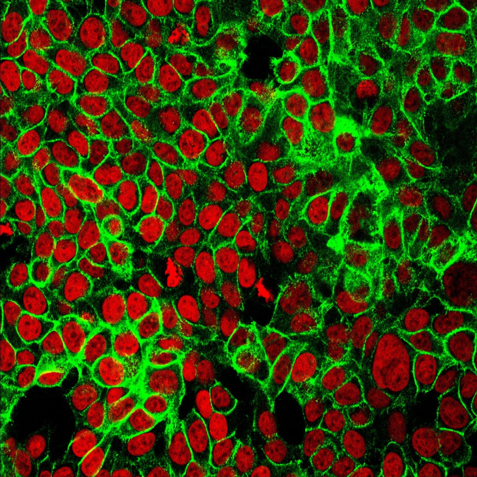 Fluorescence micrograph of human colon cancer cells, with cell nuclei stained red and the adhesion protein E-cadherin stained green. Part of the NCI Cancer Close Up 2015 collection. Image: NCI Center for Cancer Research, via the NIH Image Gallery and Wikimedia Commons (public domain, U.S. government work). Source page: https://commons.wikimedia.org/wiki/File:Human_Colon_Cancer_Cells_(42301616611).jpg
